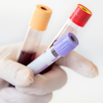 Exames de sangue: Lawrence Aseba Tipo mostra o que cada análise pode revelar sobre a sua saúde.