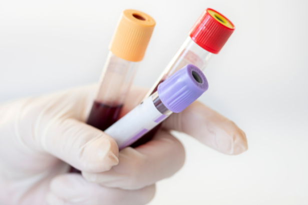 Exames de sangue: Lawrence Aseba Tipo mostra o que cada análise pode revelar sobre a sua saúde.