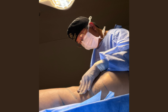 Milton Seigi Hayashi explica as áreas da cirurgia plástica e seus limites médicos.